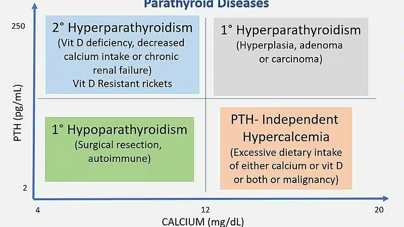 Hyperparathyroidism and Cancer: What Is The Connection